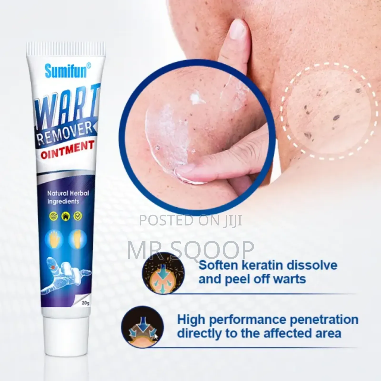 Sumifun Skin Tag Wart Remover Ointment – Pack of 2