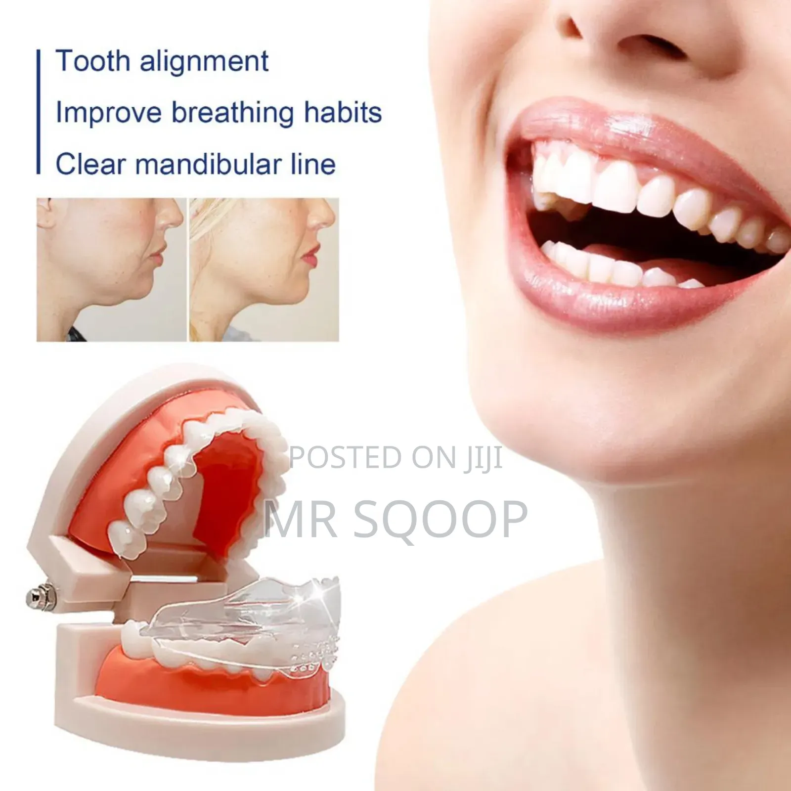 Jawbone Dental Alignment Brace Repair Teeth Deformity Stent