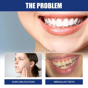 Jawbone Dental Alignment Brace Repair Teeth Deformity Stent
