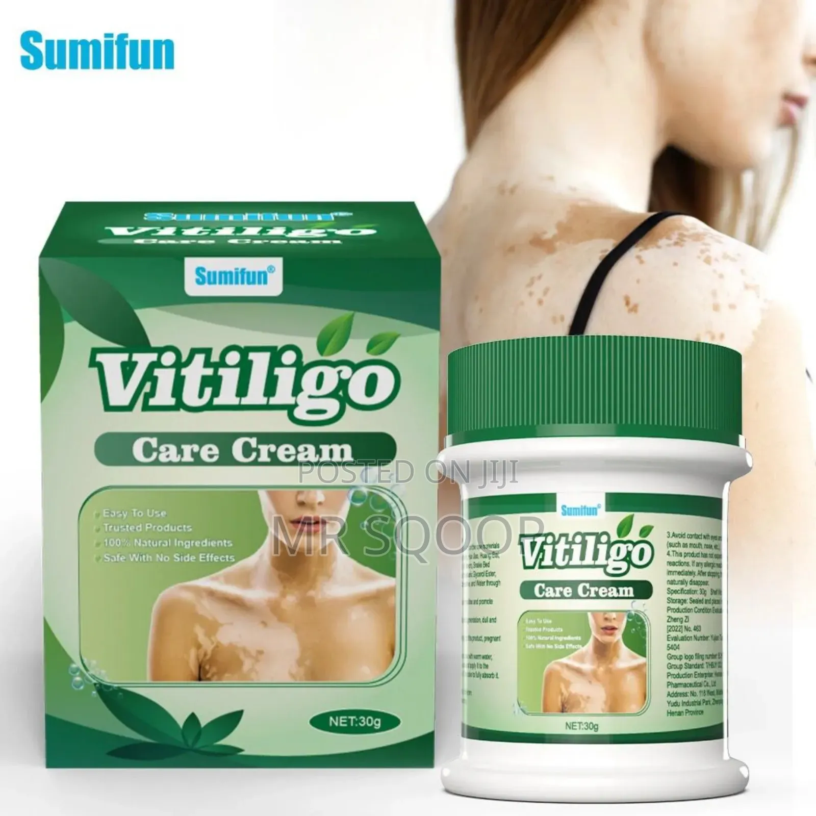 Vitiligo Care Relief Cream Skincare