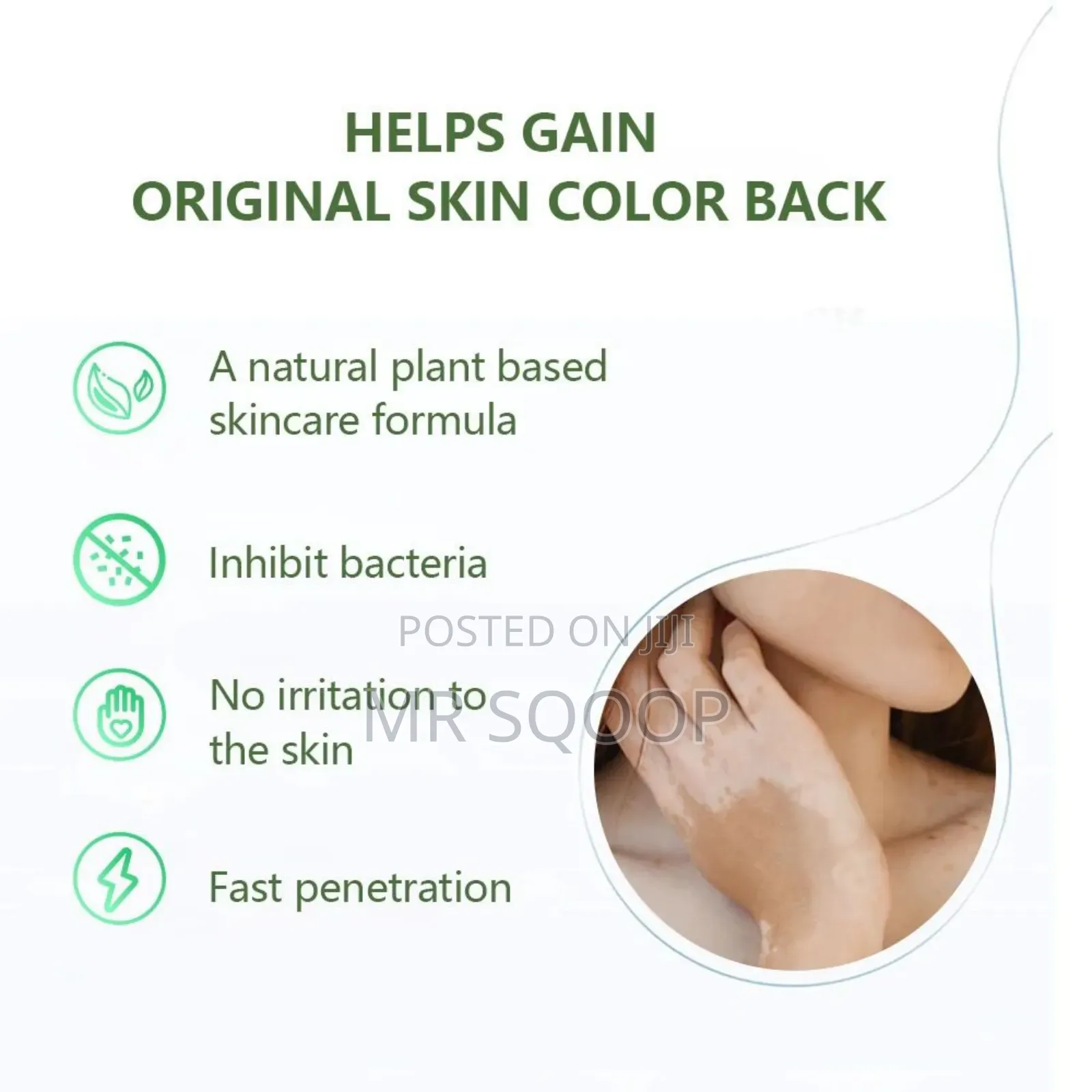 Vitiligo Care Relief Cream Skincare