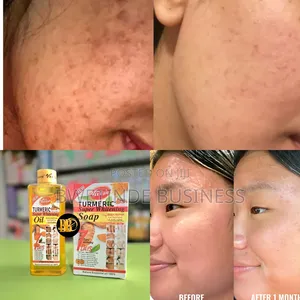 Photo - Tumeric Brightening Oil Soap