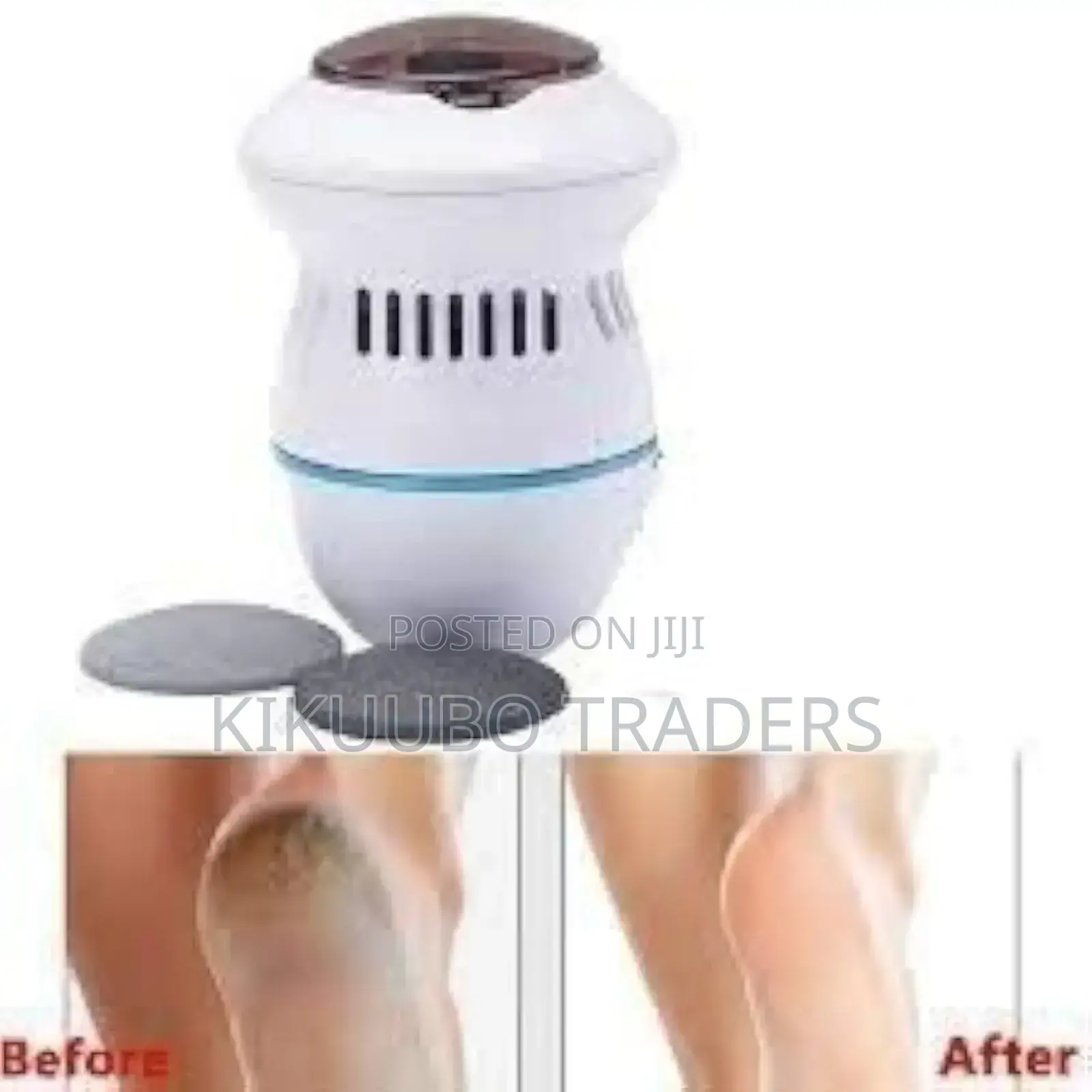 Electric Callus Remover