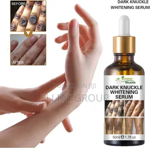 Photo - SMIO Health Dark Knuckle Remover Serum