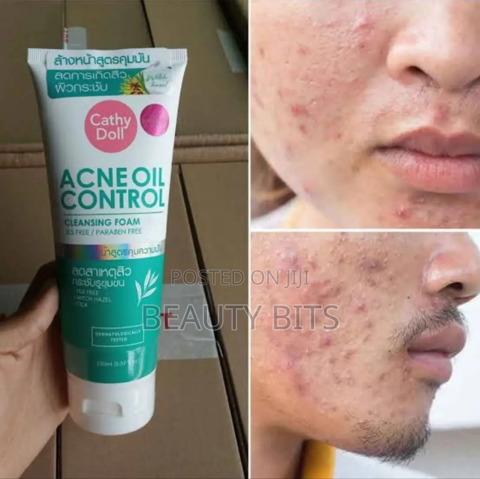 Acne Oil Control Cleansing Form