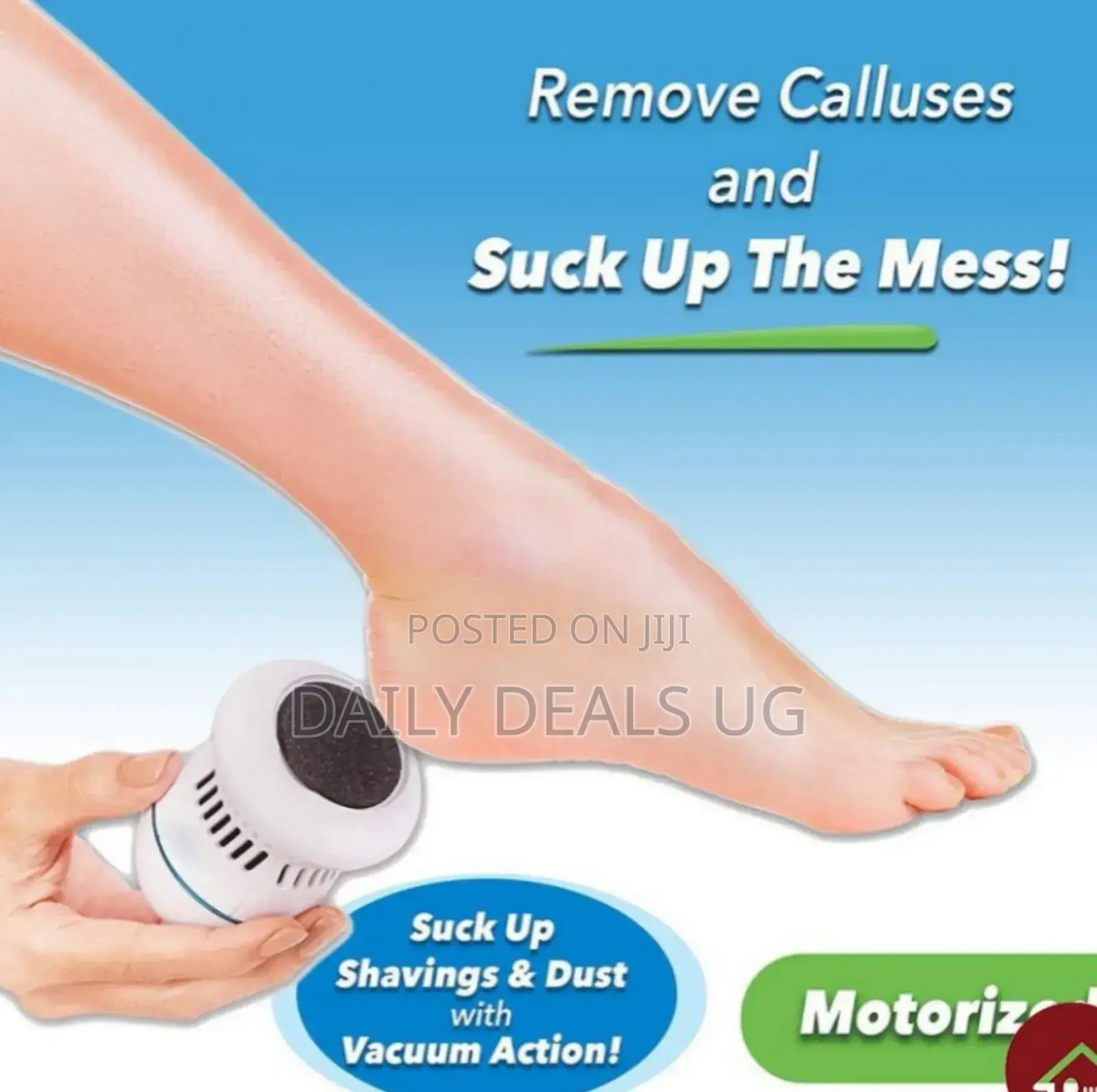 Electric Callus Remove