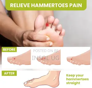 Silicone Toe Spacers