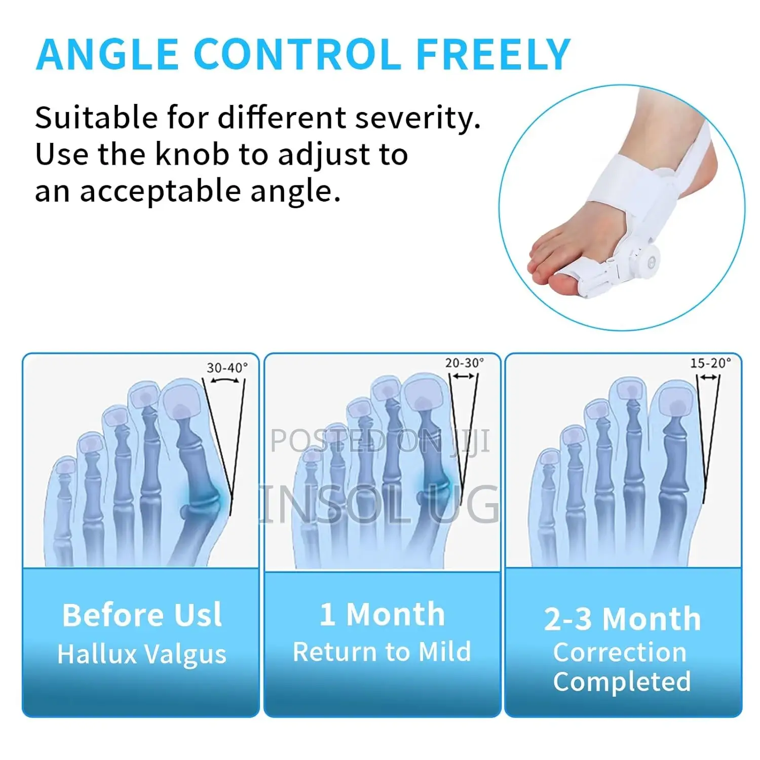 Bunion Corrector - Big Toe Straightener