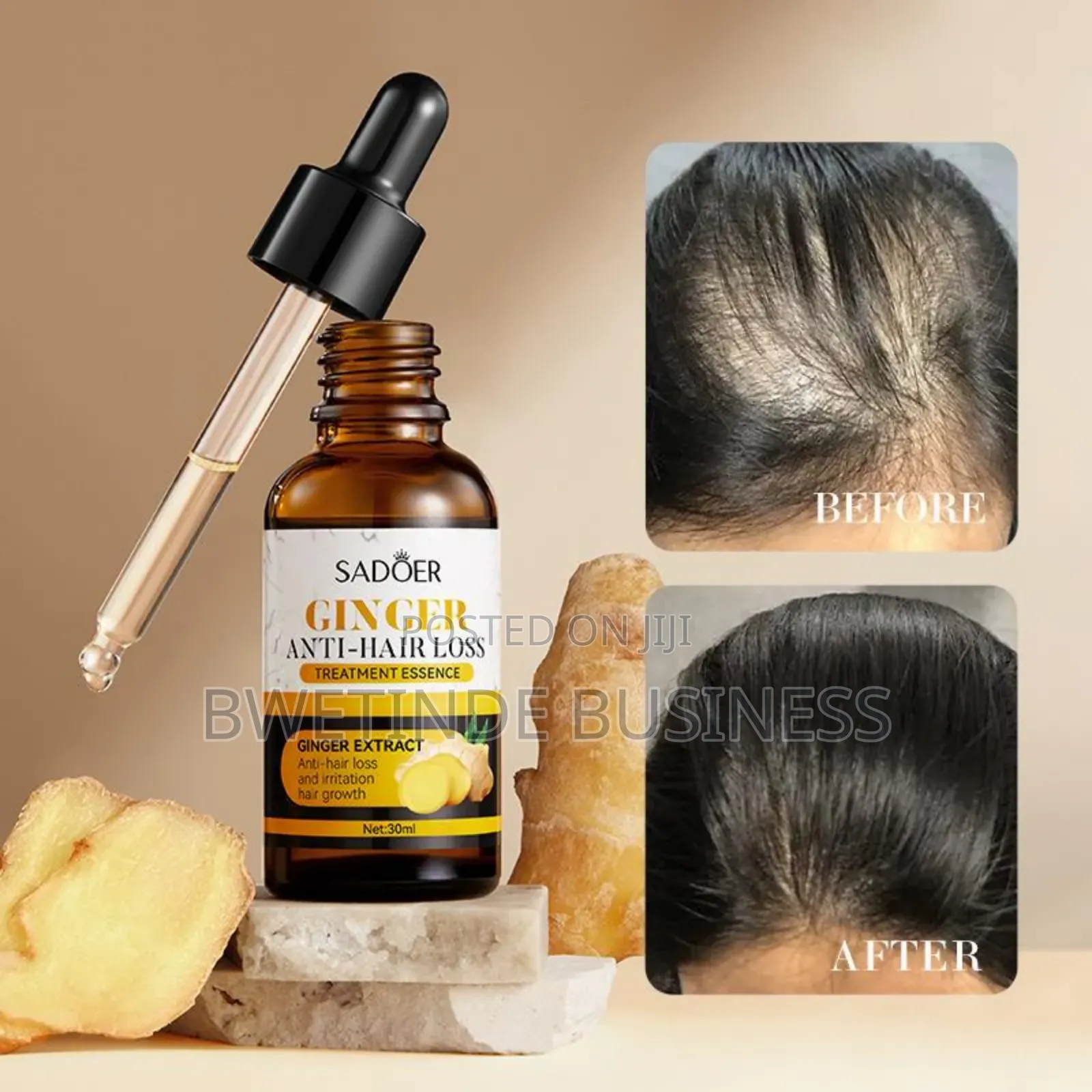 Ginger Anti-Hair Loss Oil Essence 30ml