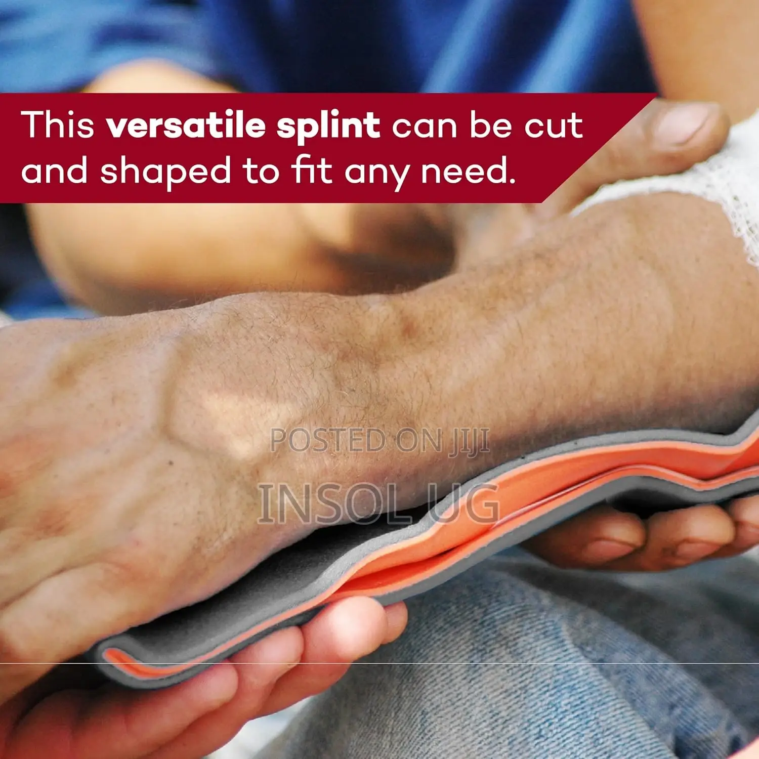 SAM Splint
