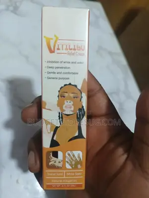 Vitiligo Treatment Cream