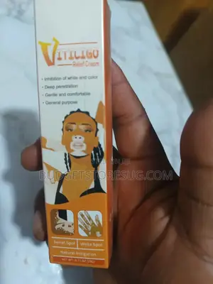 Vitiligo Treatment Cream