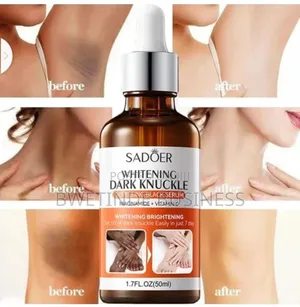 Photo - Whitening Dark Knuckle Body Serum for Dark Skin