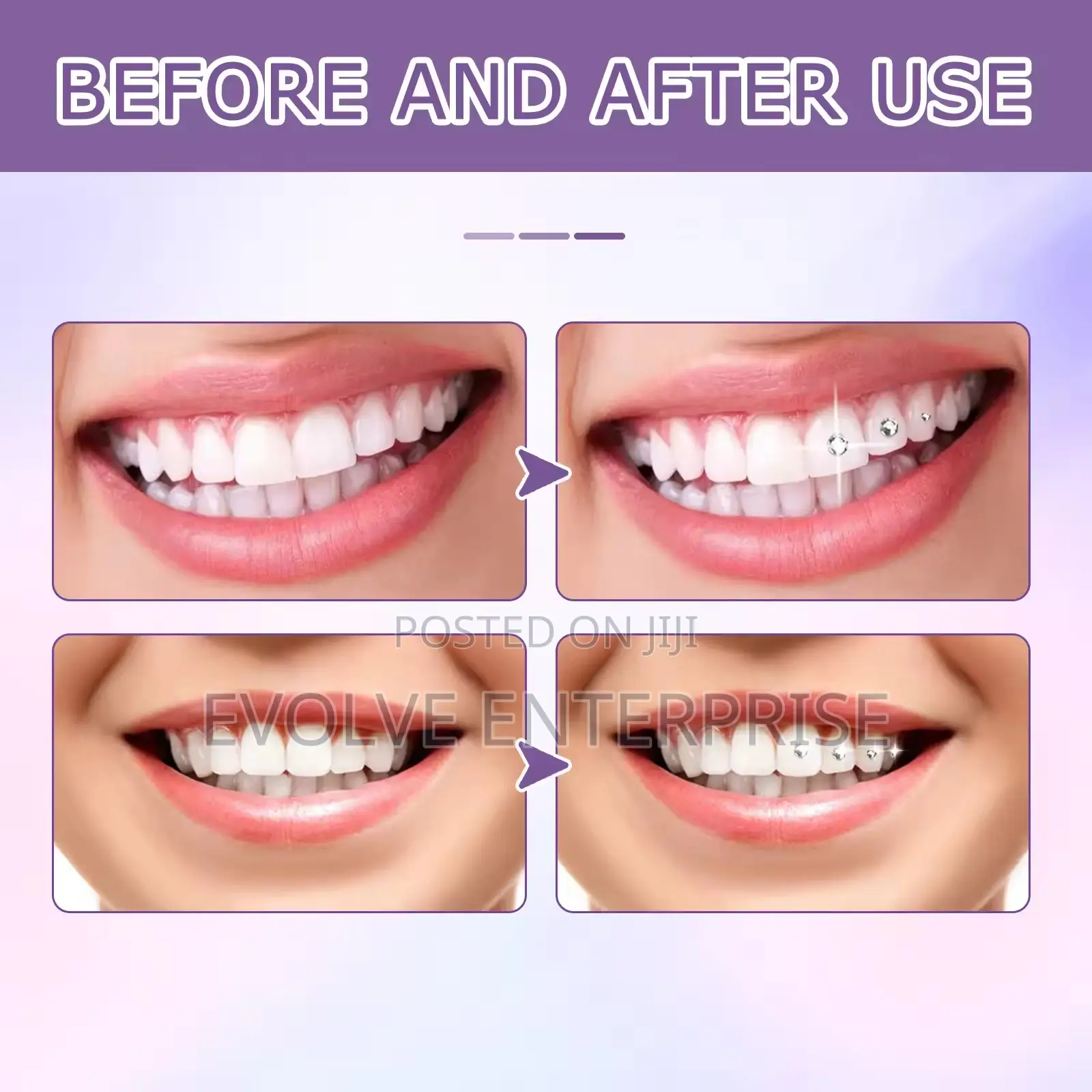 Tooth Gem Glue Dental Adhesive For Tooth Gems