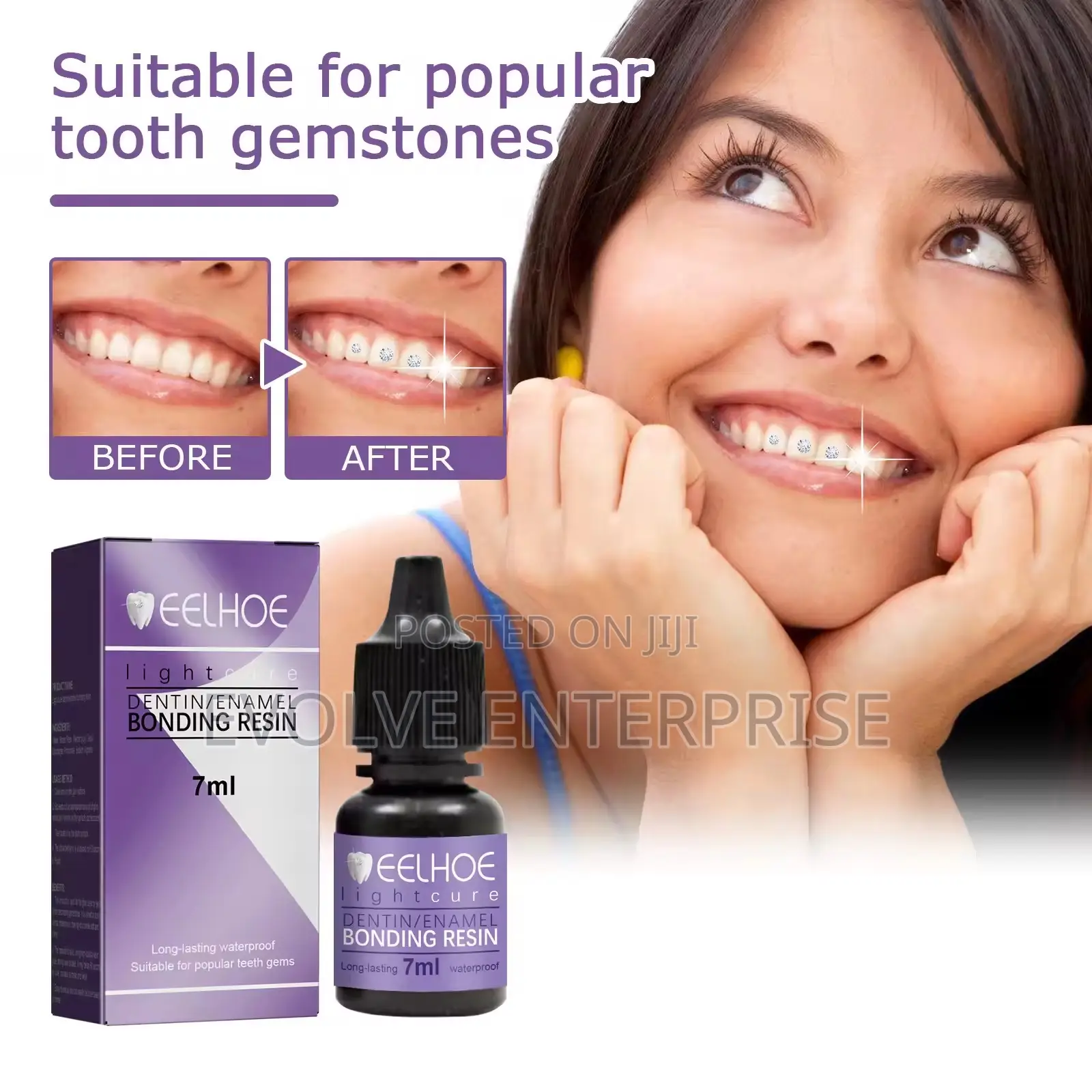 Tooth Gem Glue Dental Adhesive For Tooth Gems