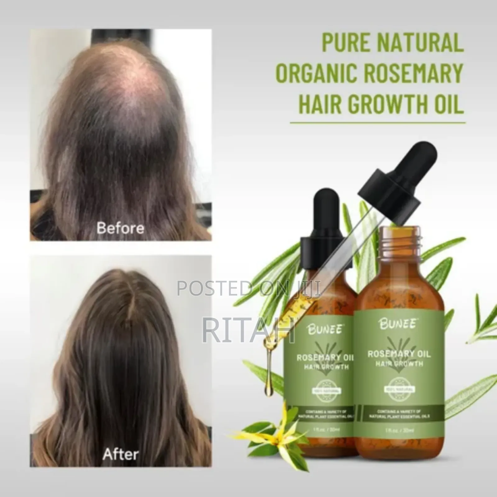 Rosemary Hair Growth Treatment Oil