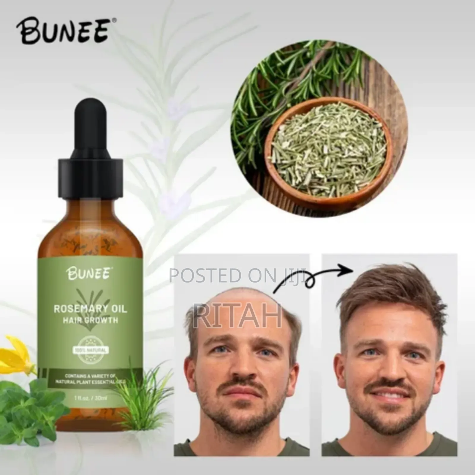 Rosemary Hair Growth Treatment Oil