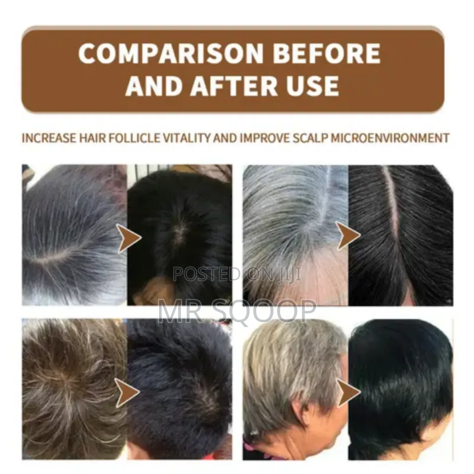 Jaysuing Anti White Grey Hair Treatment Restoration Spray