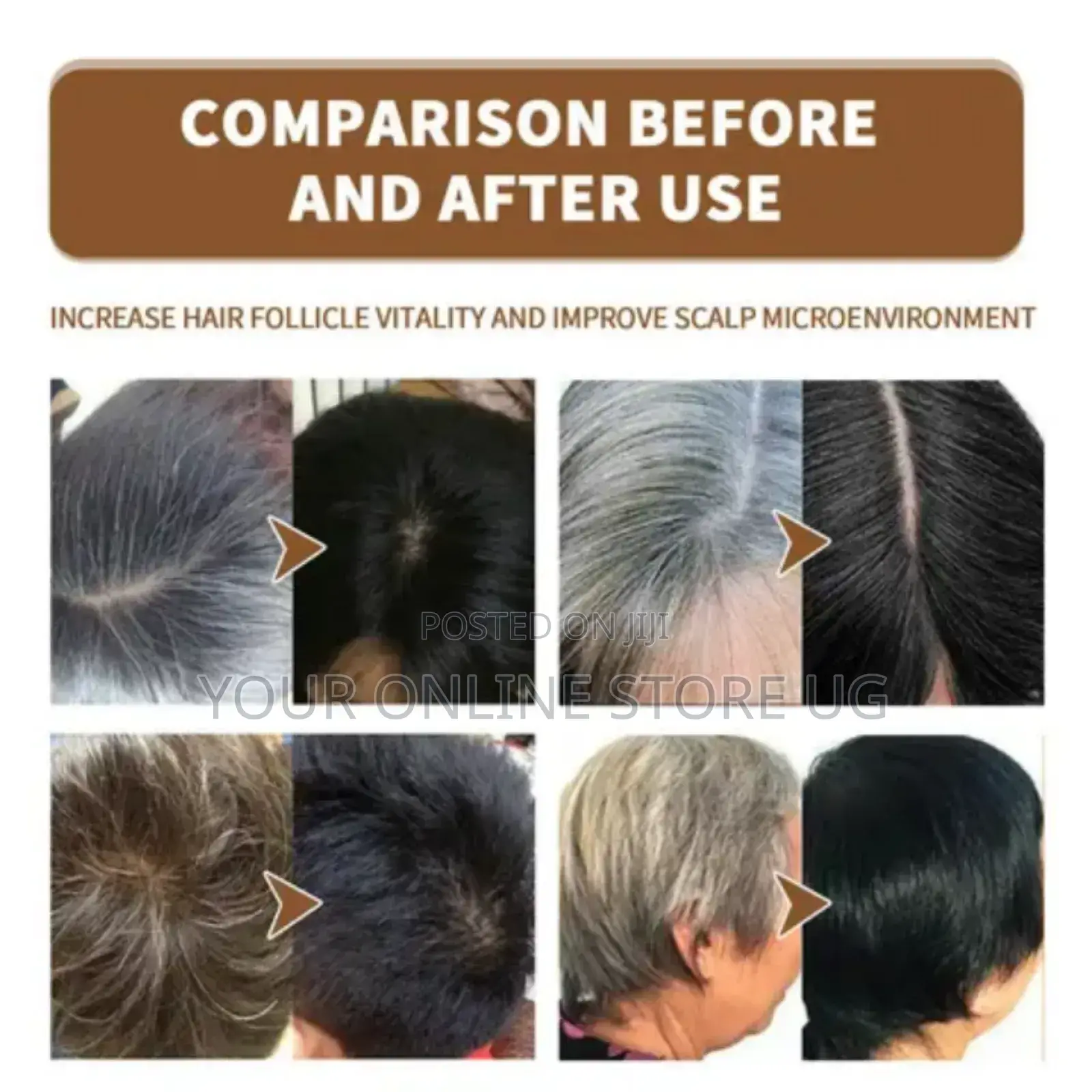 Jaysuing Anti White Grey Hair Treatment Restoration Spray