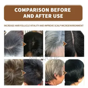 Jaysuing Anti White Grey Hair Treatment Restoration Spray