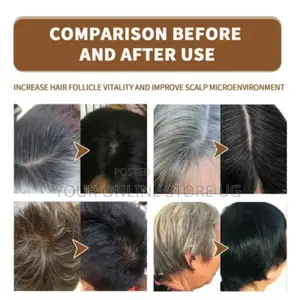 Jaysuing Anti White Grey Hair Treatment Restoration Spray