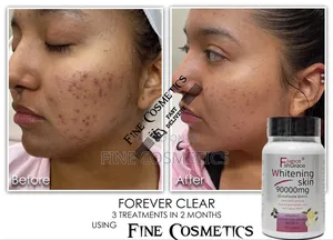 Effective Skin Whitening Glutathione Pills Wiz Vitamin C.120