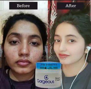 Gorgeous Beauty Cream for Spots and Dark Circles Under Eyes