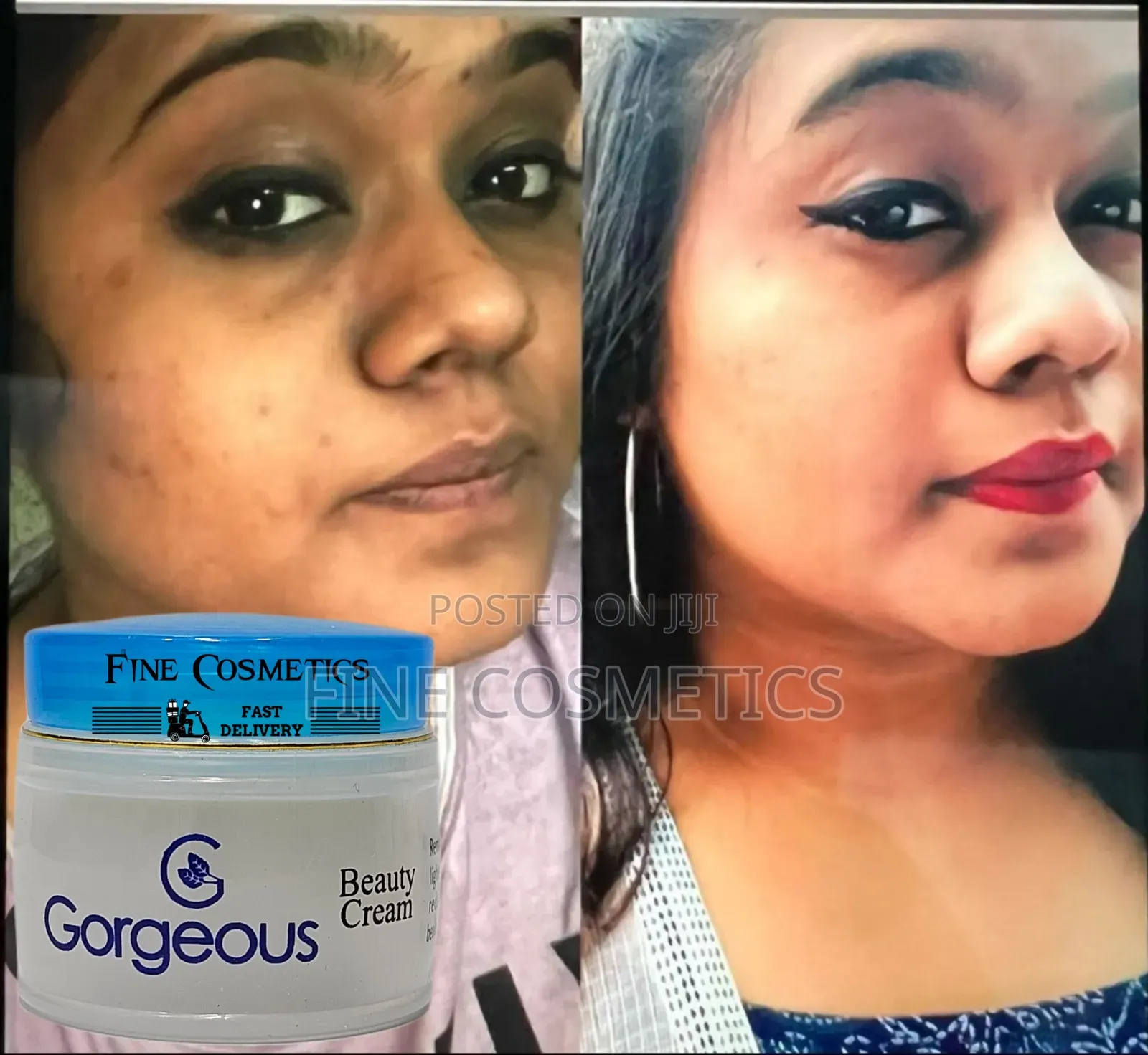 Gorgeous Beauty Cream for Spots and Dark Circles Under Eyes