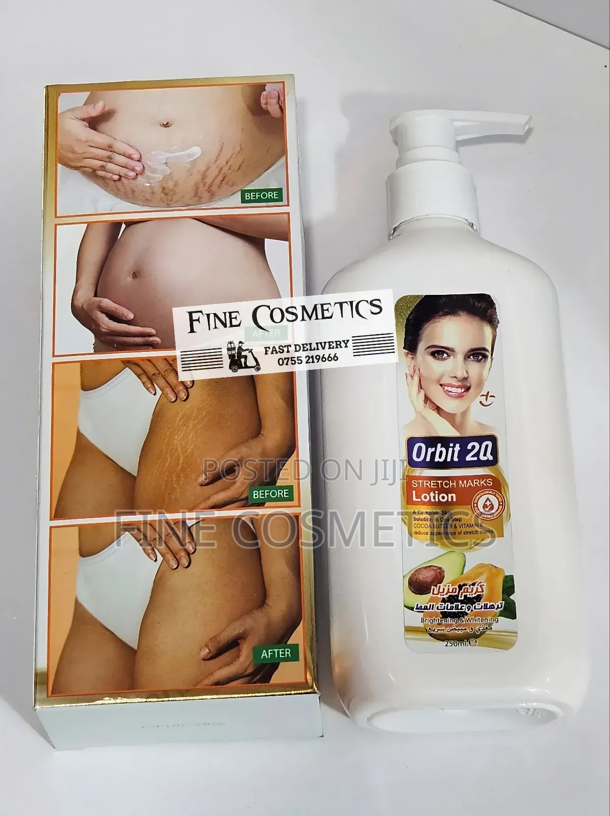 ORBI 20 STRETCH MARKS LOTION, Cocoa Butter Anti-Stretch Mark