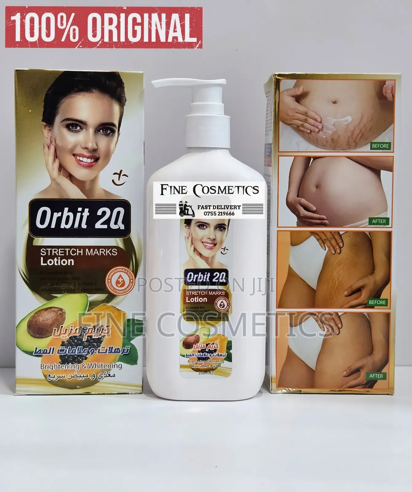 ORBI 20 STRETCH MARKS LOTION, Cocoa Butter Anti-Stretch Mark