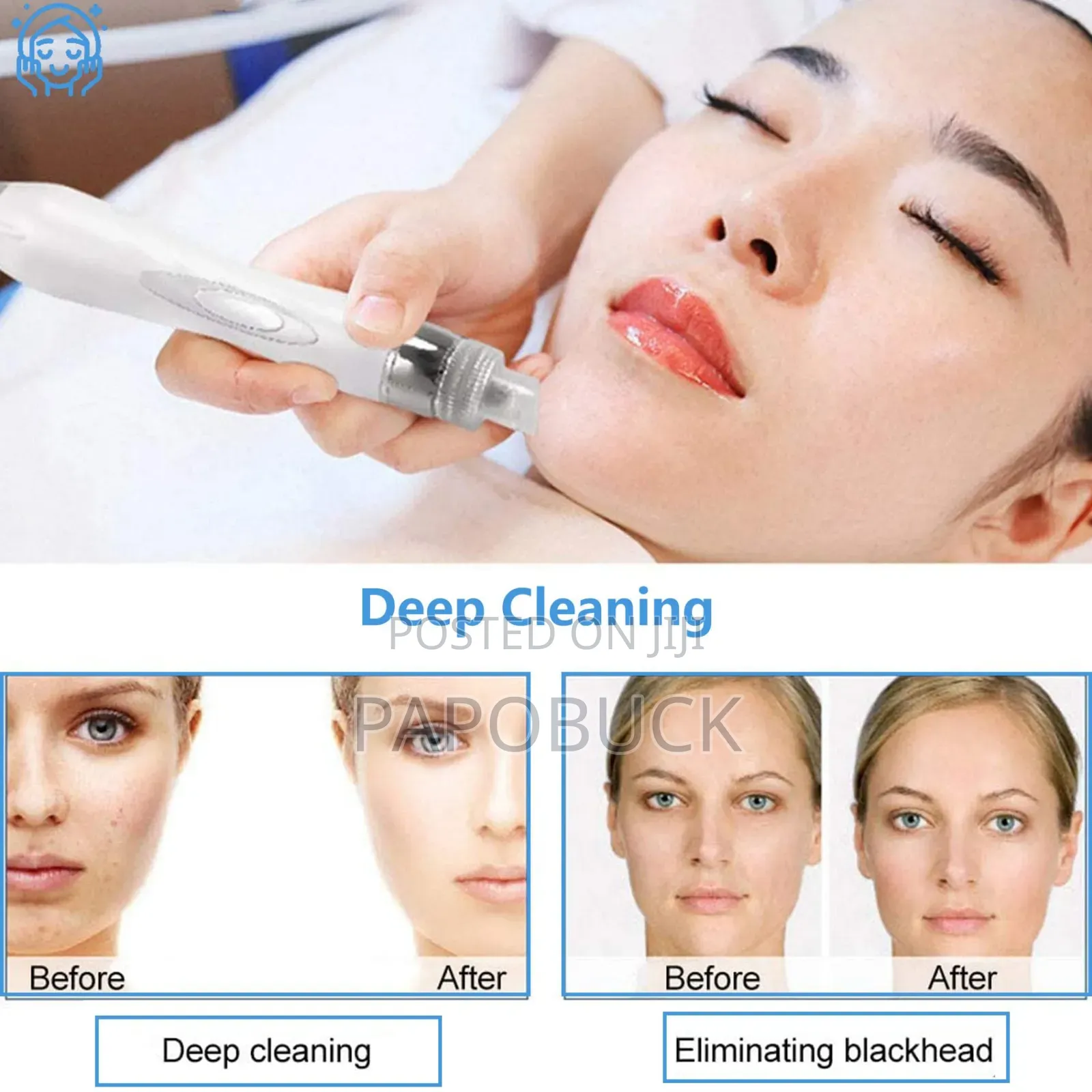 6 in 1 Hydro Oxygen Facial Machine