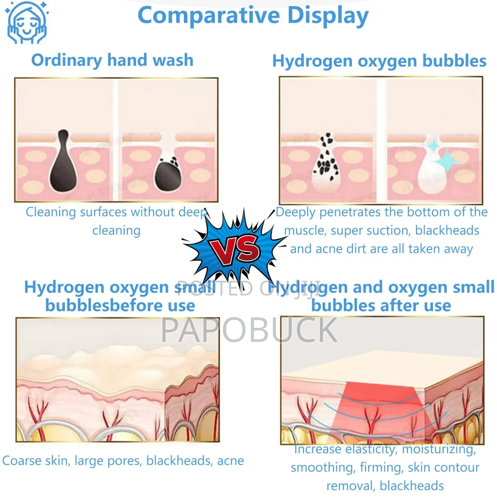 6 in 1 Hydro Oxygen Facial Machine