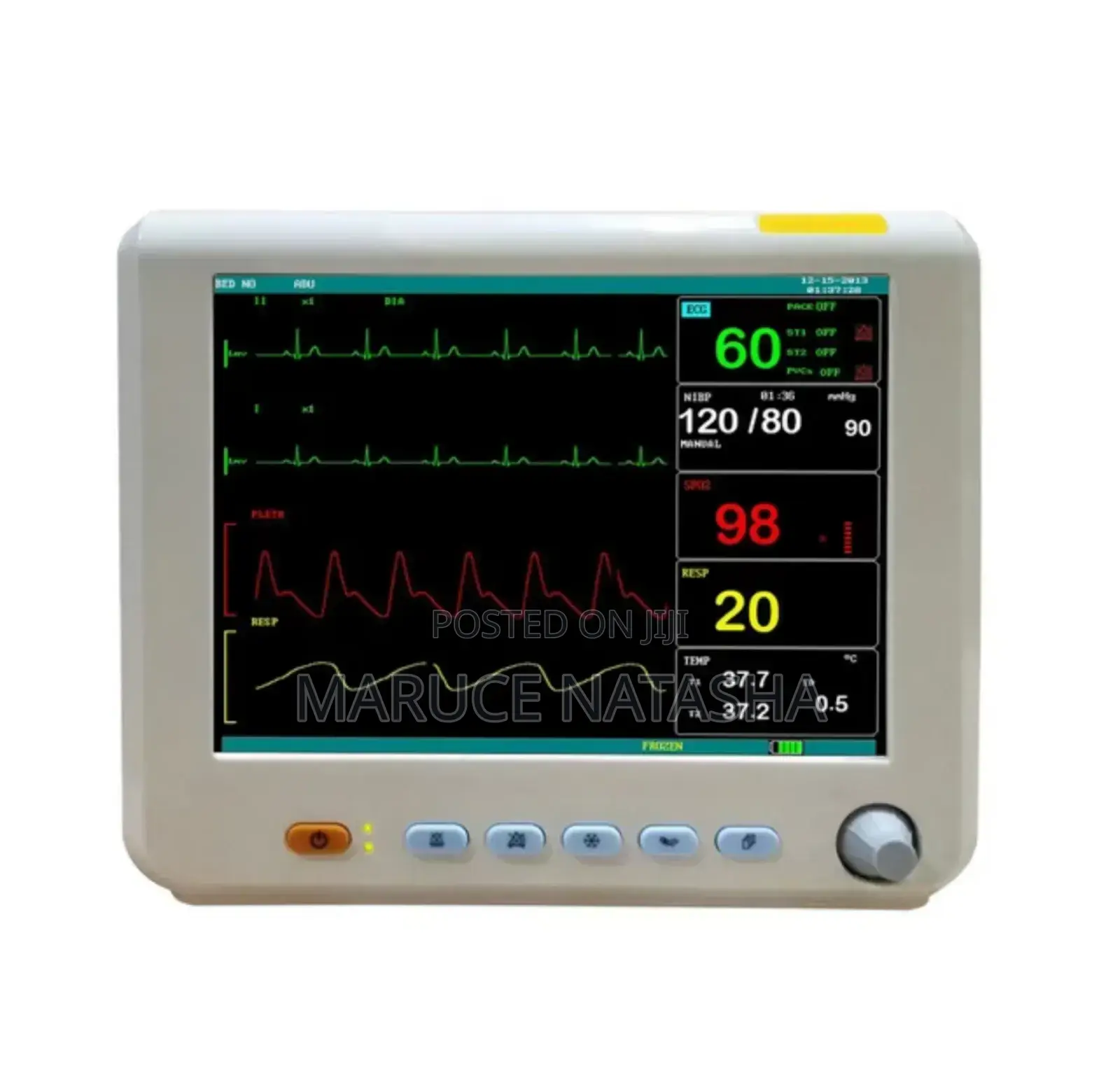 Bedside Vital Signs Monitor