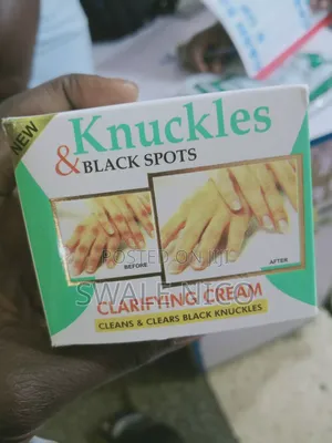 Photo - Knuckles and Black Spots Cream