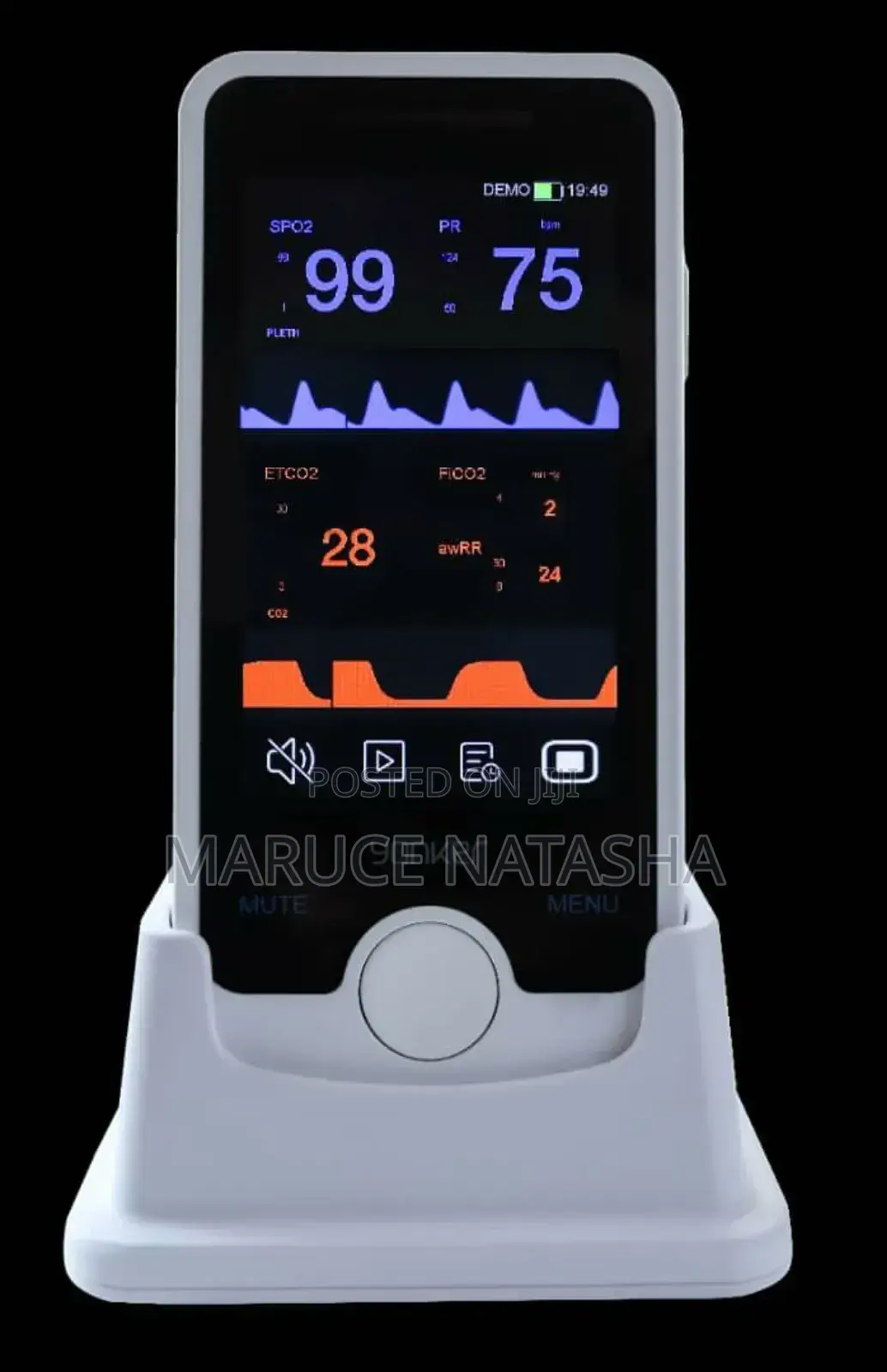 Handheld Vital Signs Monitor
