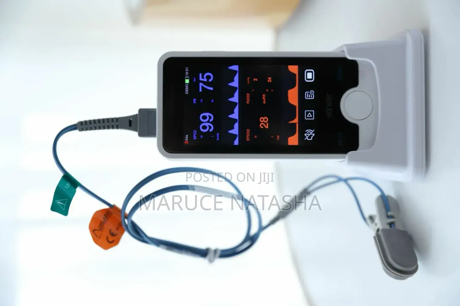 Handheld Vital Signs Monitor