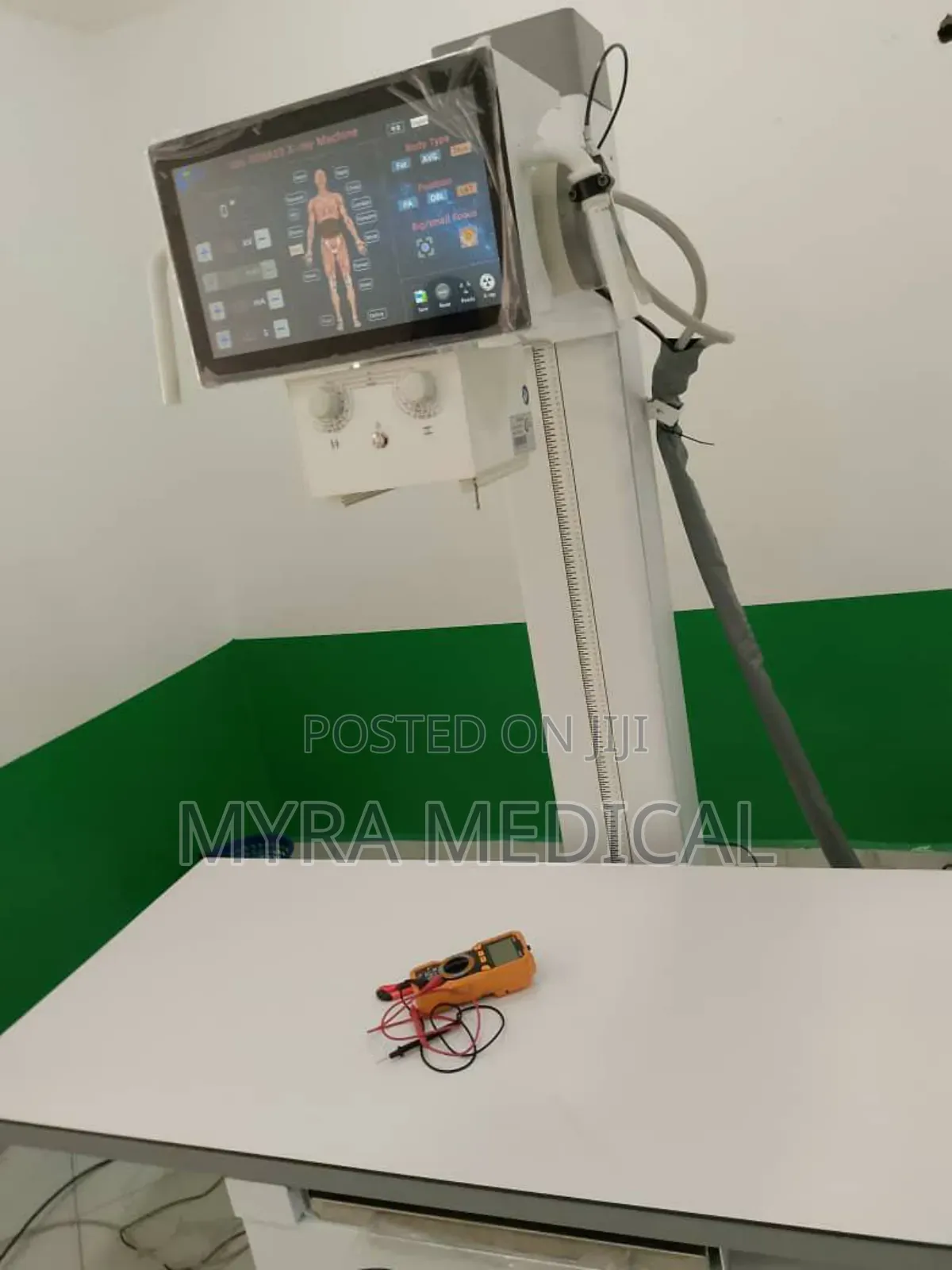Digital Xray