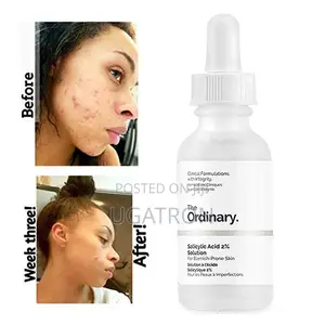 Salicylic Acid Serum
