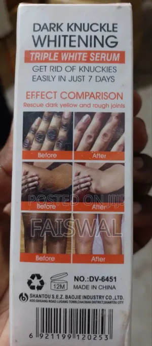 Photo - Dark Knuckle Whitening