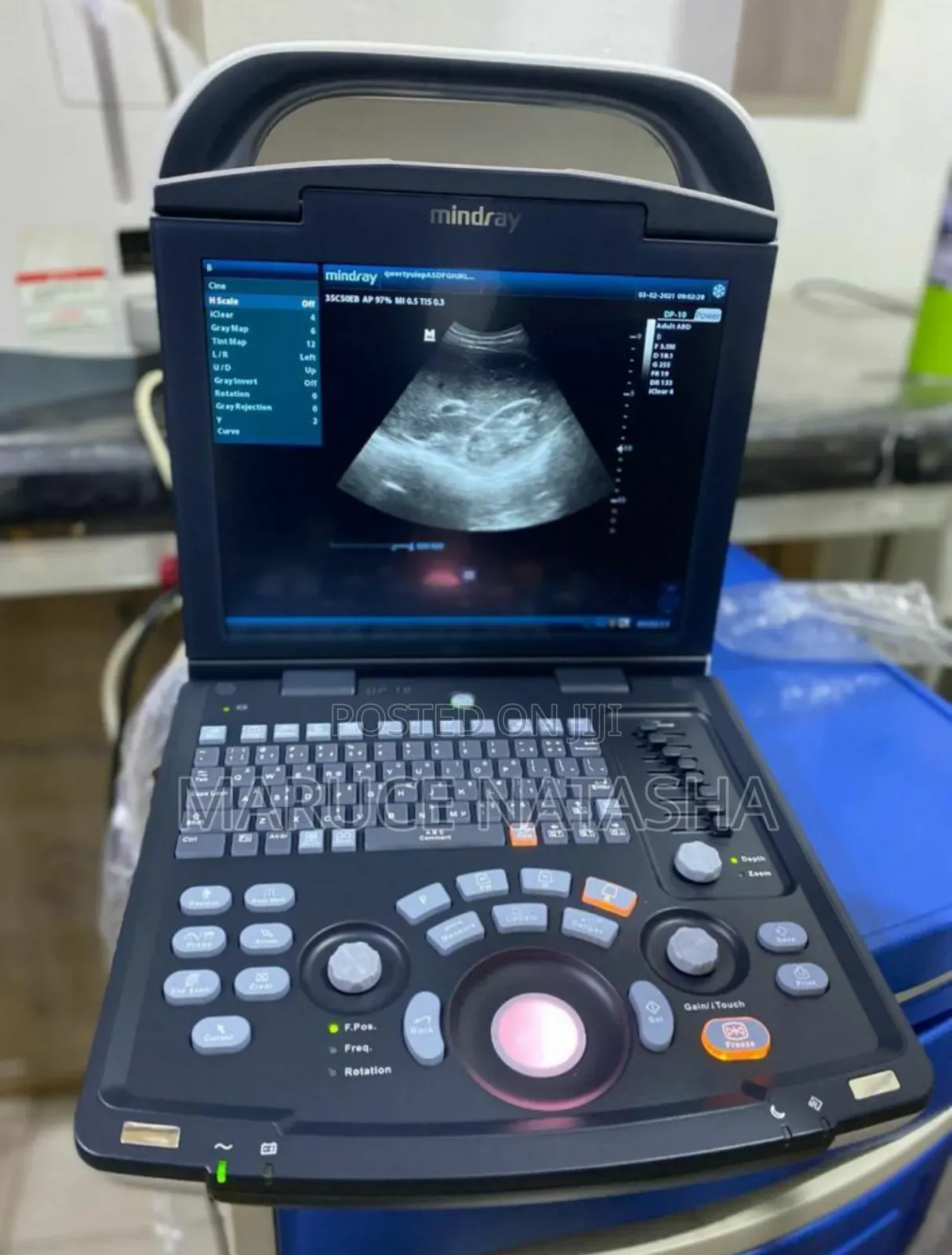 High Quality Brand New Mindray Dp10 Ultrasound Scan Machine