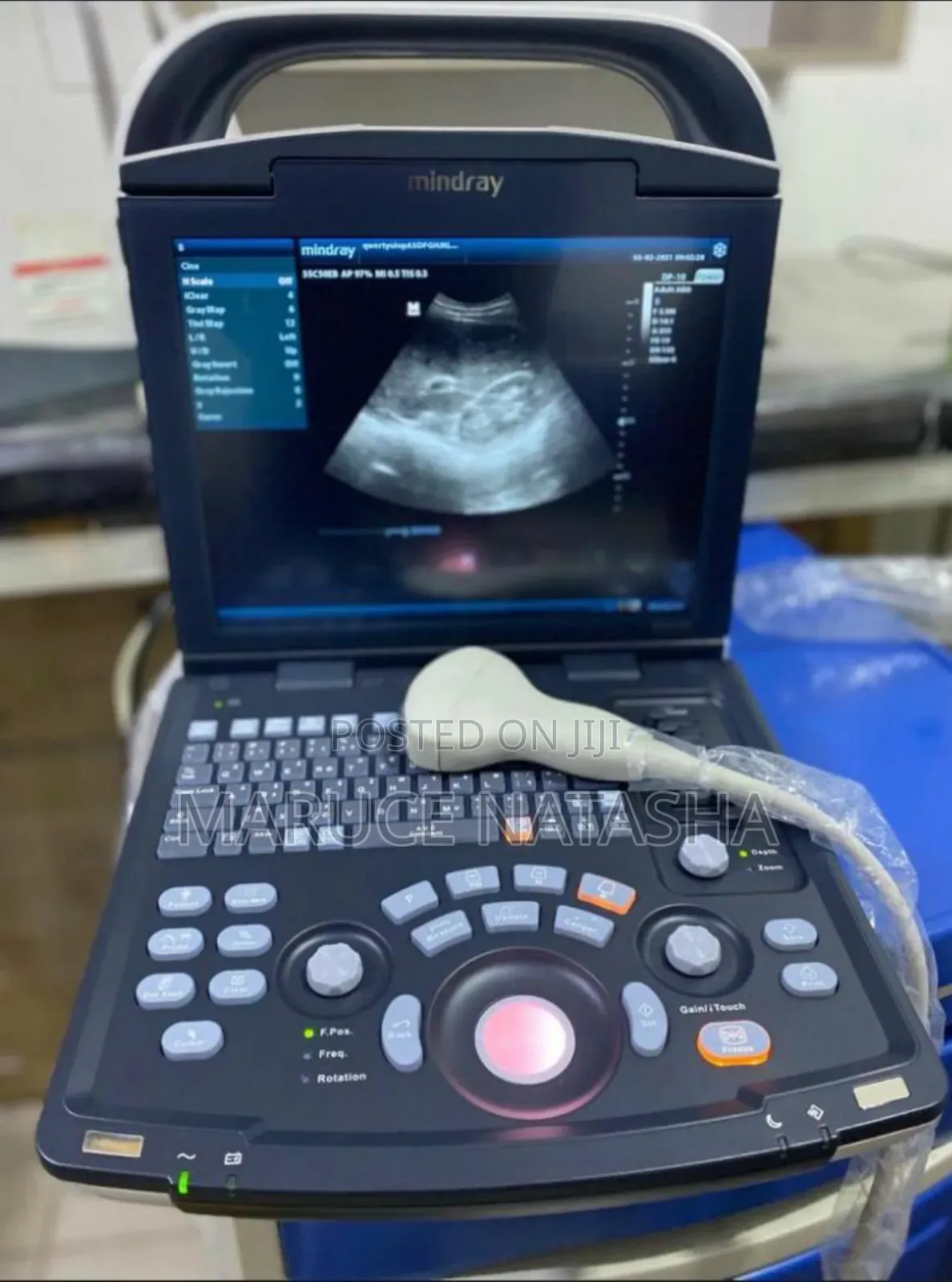 High Quality Brand New Mindray Dp10 Ultrasound Scan Machine