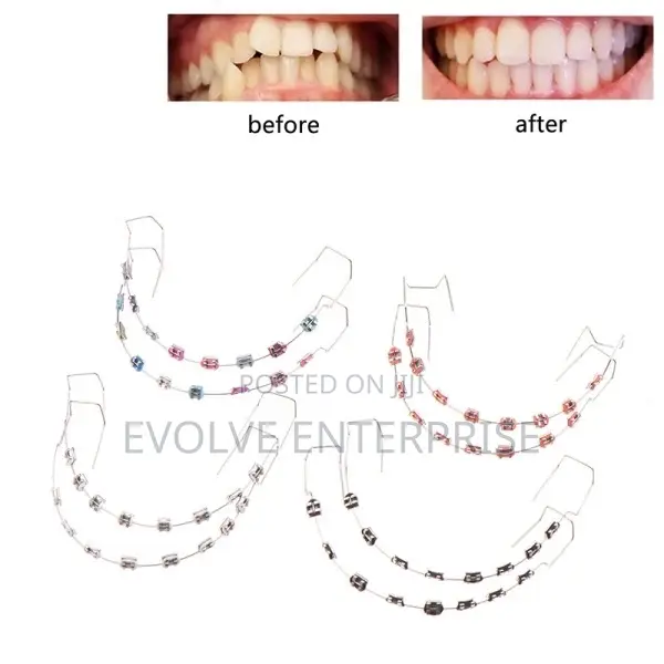 1pair Colorful Temporary Tooth Braces With Metal Wires