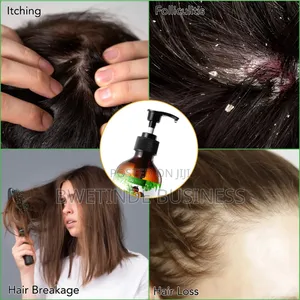 Aliver 3-in-1 Hair Growth Shampoo for Hair Health and Growth