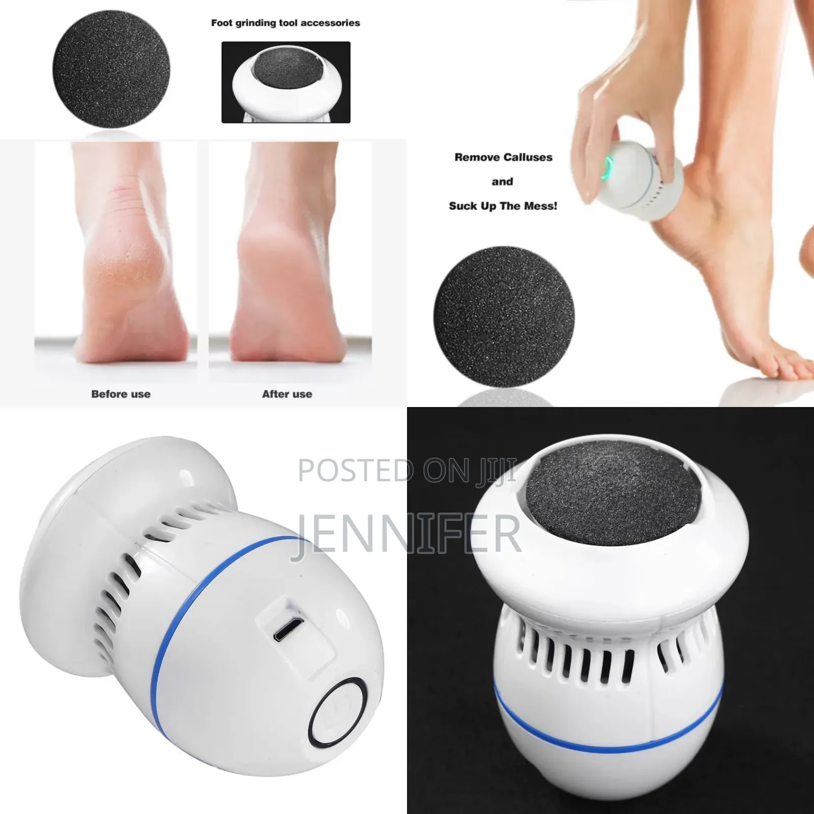 Rechargeable Painless Feet Callus Removing Device