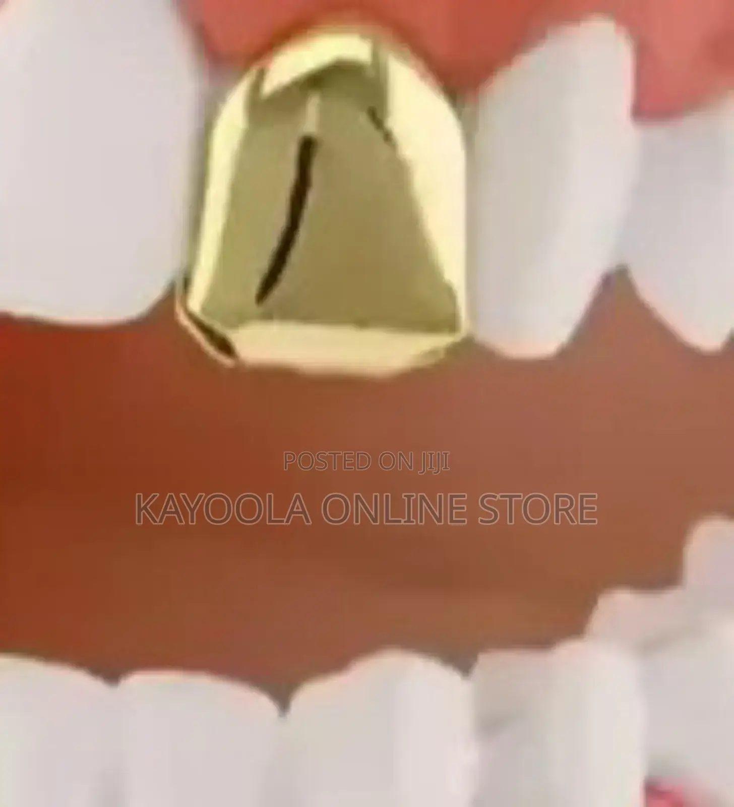 Hiphop Single Tooth Top Bottom Dental Teeth Caps