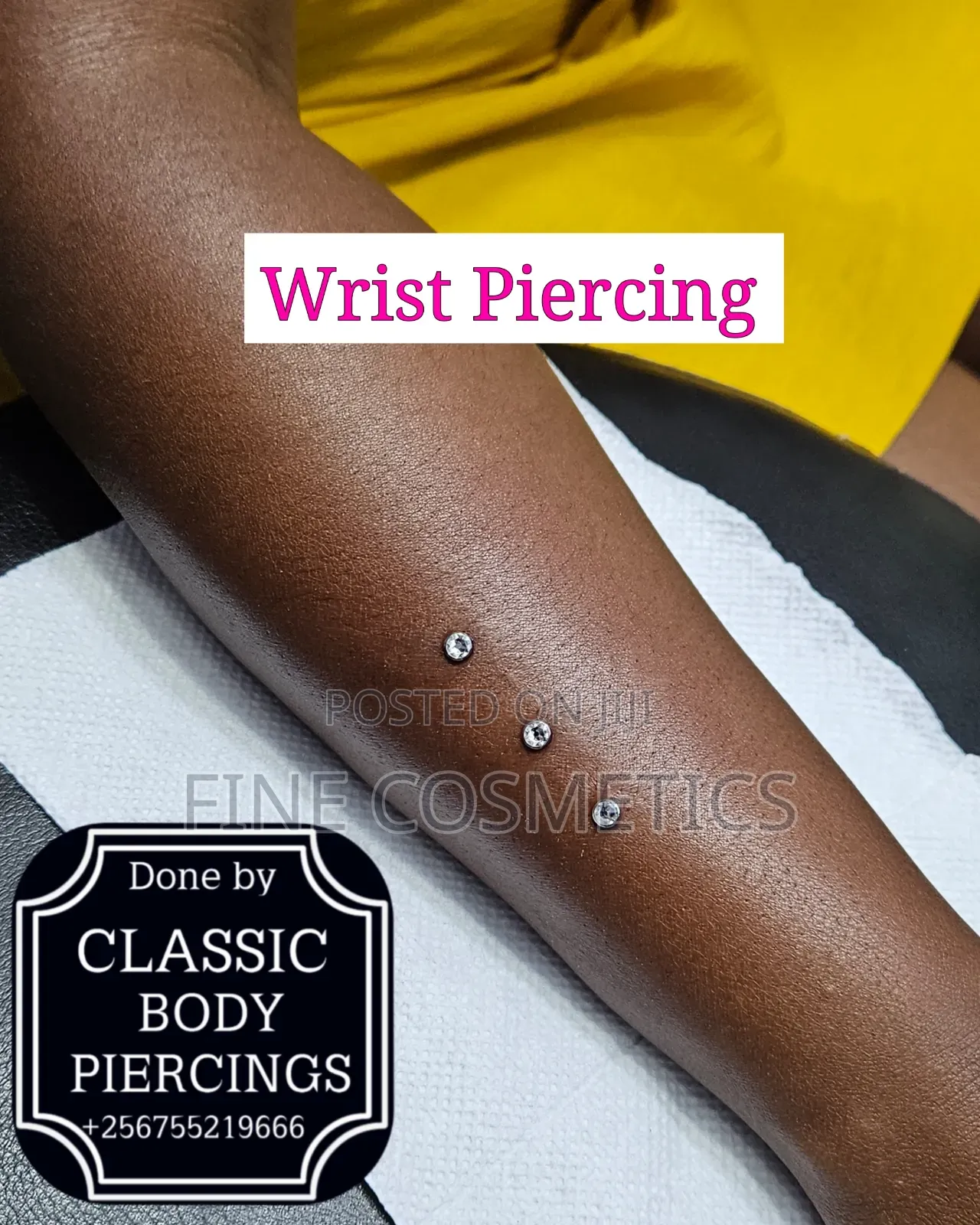 5pcs Disposable Dermal Piercing Biopsy Puncher Anchor Punch