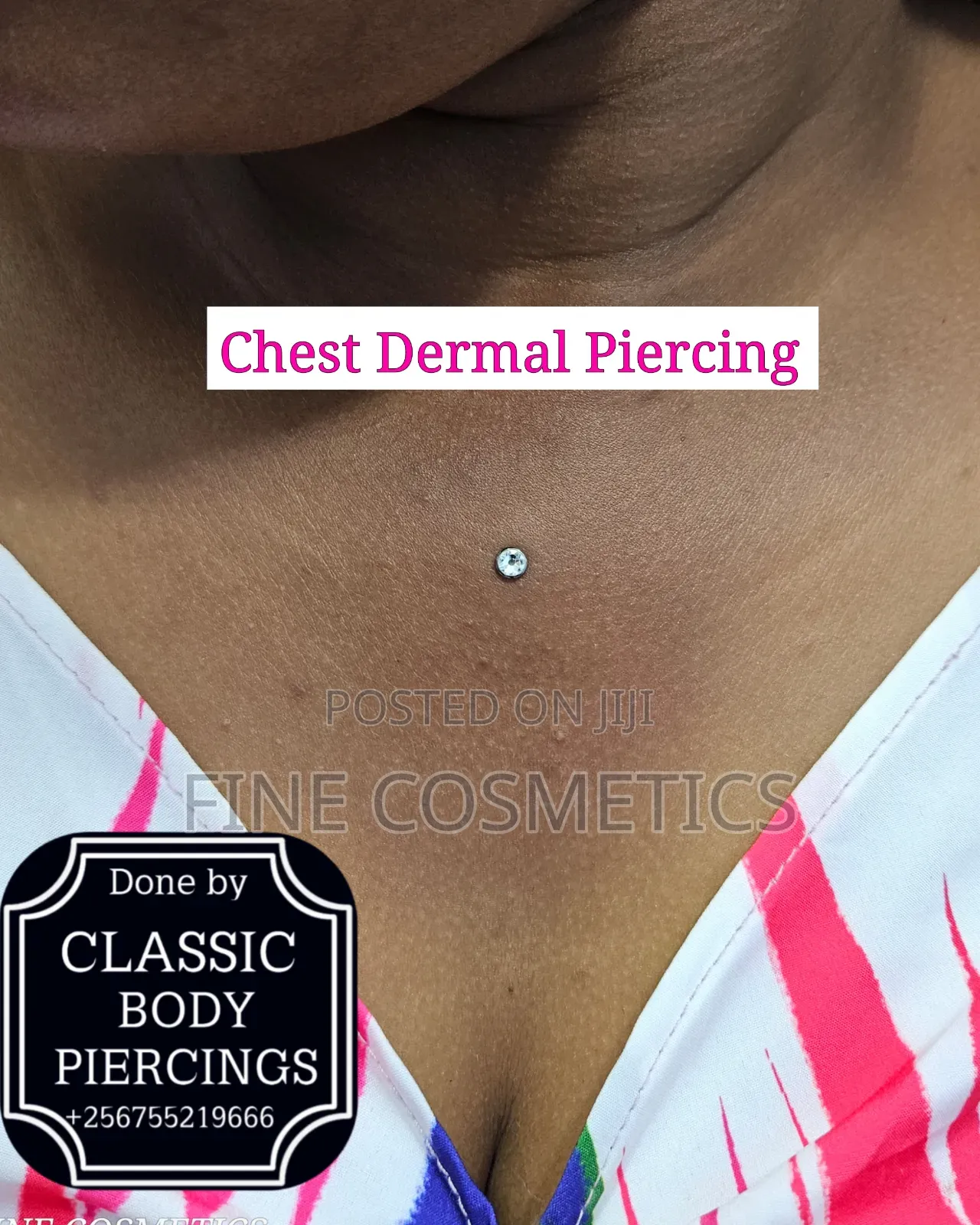 5pcs Disposable Dermal Piercing Biopsy Puncher Anchor Punch