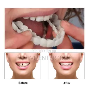 Denture Cover Veneer Snap-on Teeth Kit Fake Temporary Tooth