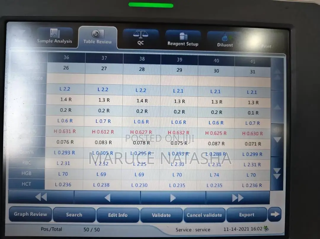 High Quality Bc20 CBC Machine (Hematology Analyzer)