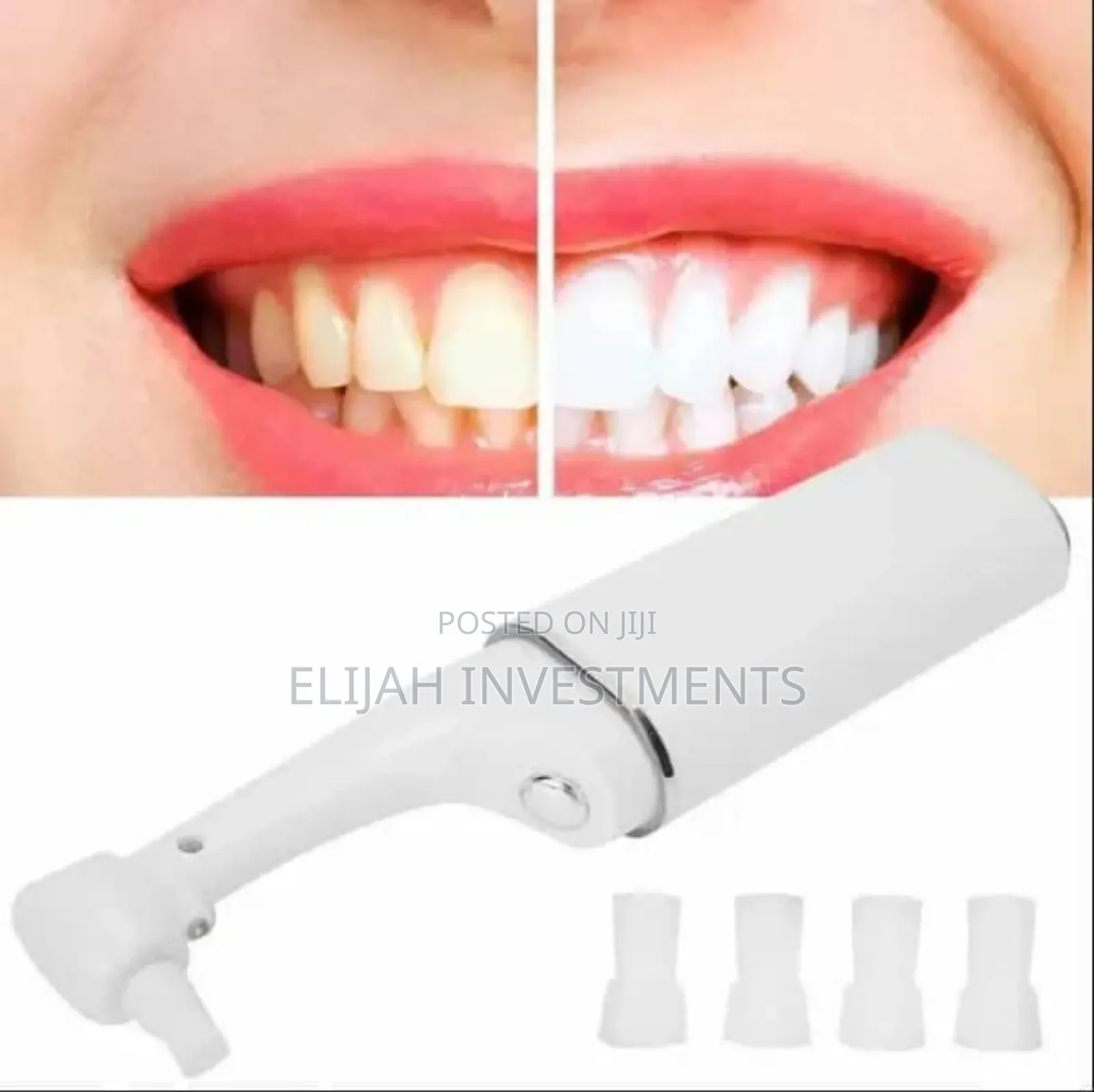Beauty Tools
Spin Smile Professional
Grade Tooth Polisher